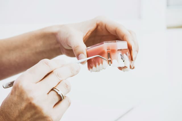 dental implant treatment in manchester