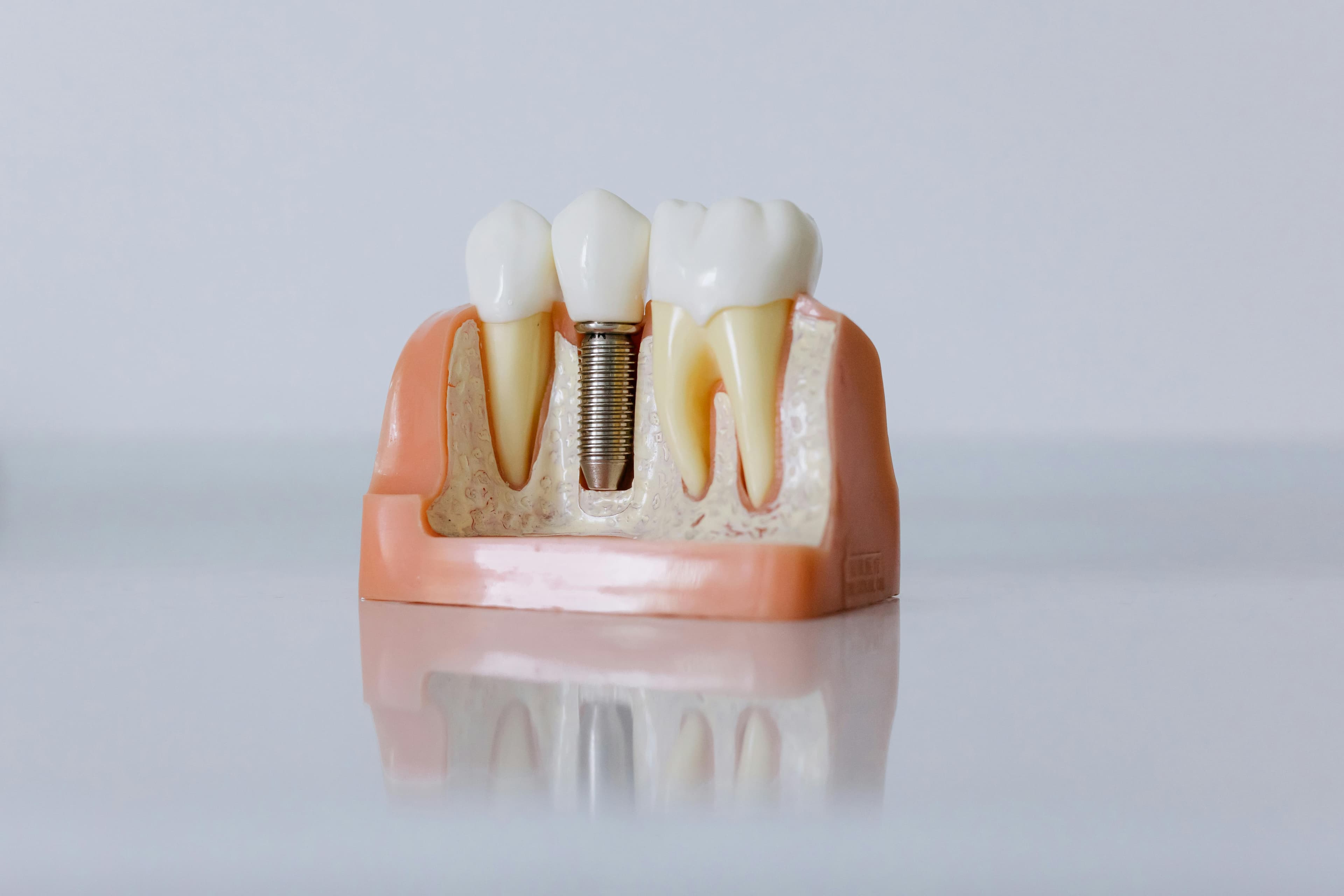 Dental Care