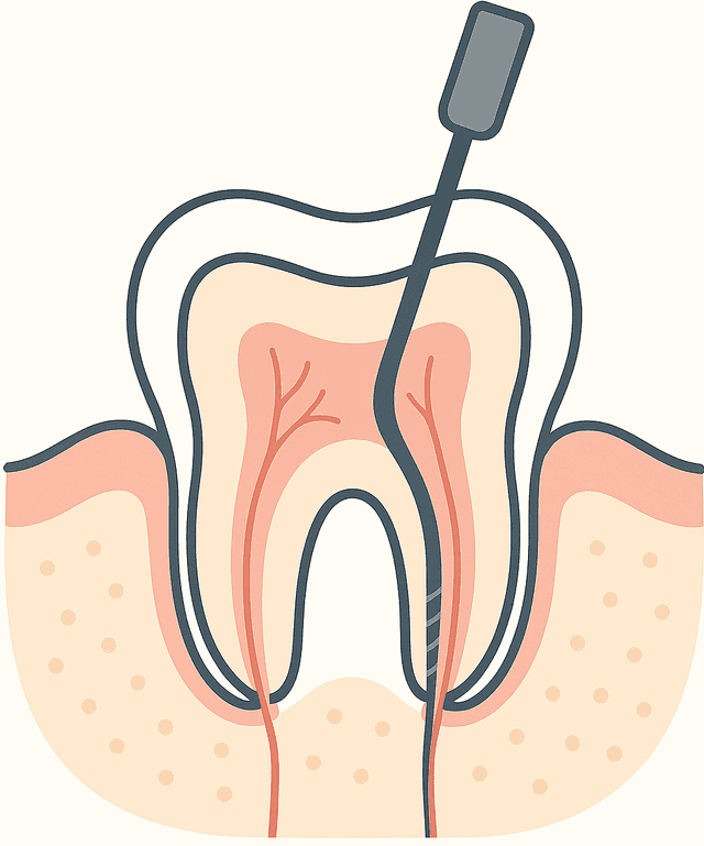 root canal treatment manchester