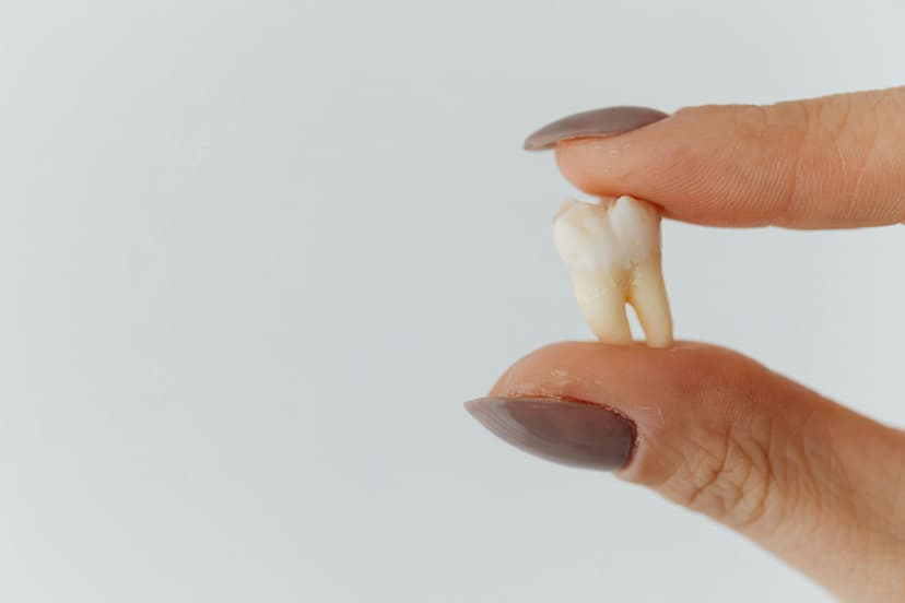 wisdom tooth extraction manchester